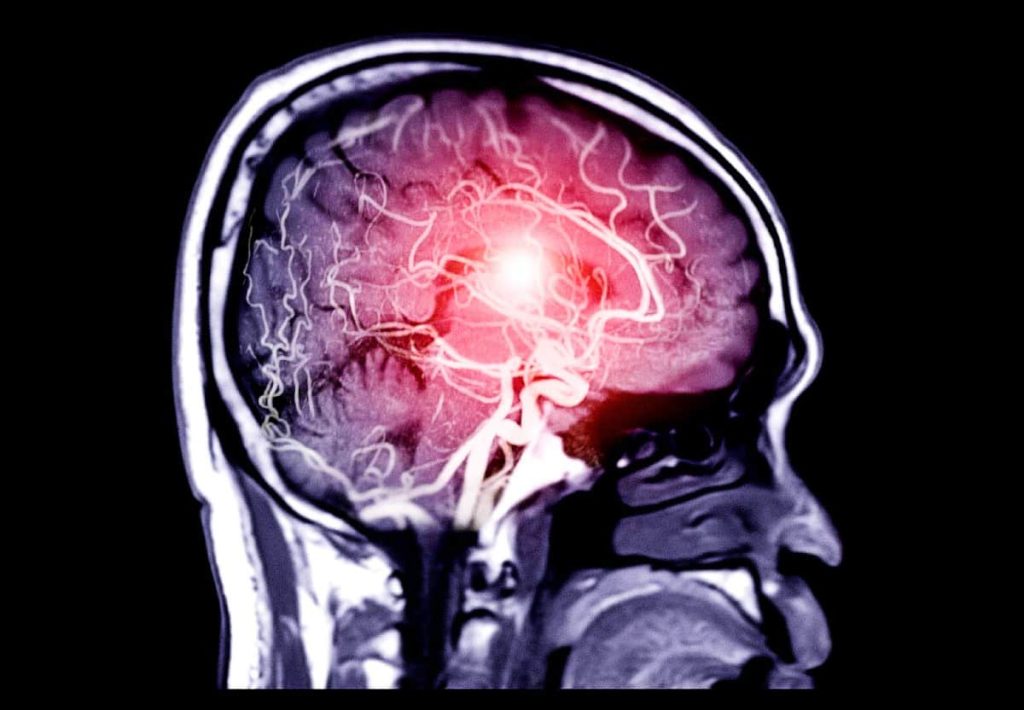 Infographic showing how salt affects the brain and neuronal communication